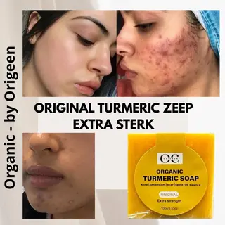 Origeen Tumeric Zeep Voor Acne, Acne Litteken, Acne Op De Rug & Pigment Verminderen - Extra Sterk - Kurkuma Zeep - Acne Zeep - Organic - Voor Gezicht