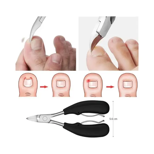 Professionele Nagelschaar thumbnail