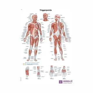 Verera.nl Anatomie Poster Triggerpoints (Nederlands/Latijn, Papier, 50x70 Cm)
