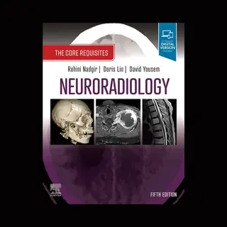 Neuroradiology