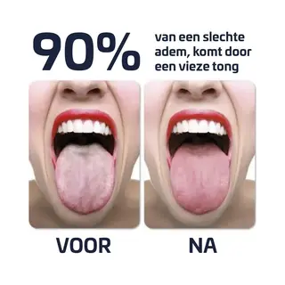 E-Shoppr Effectieve Tongschraper - Tongreiniger - Rose Goud