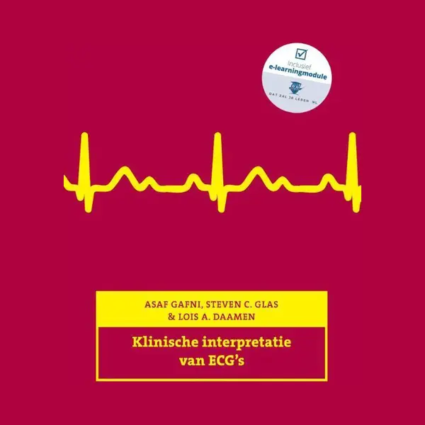 Klinische Interpretatie Van Ecg's thumbnail