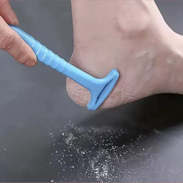Chpn – Hornhautentferner – Hornhaut Entfernen – Hornhautschaber – Hornhautmesser – Blau – Entfernt Abgestorbene Haut Und Hornhaut An Den thumbnail
