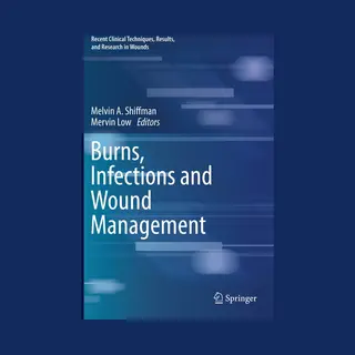 Isbn Burns, Infections and Wound Management book English Hardcover 294 pages